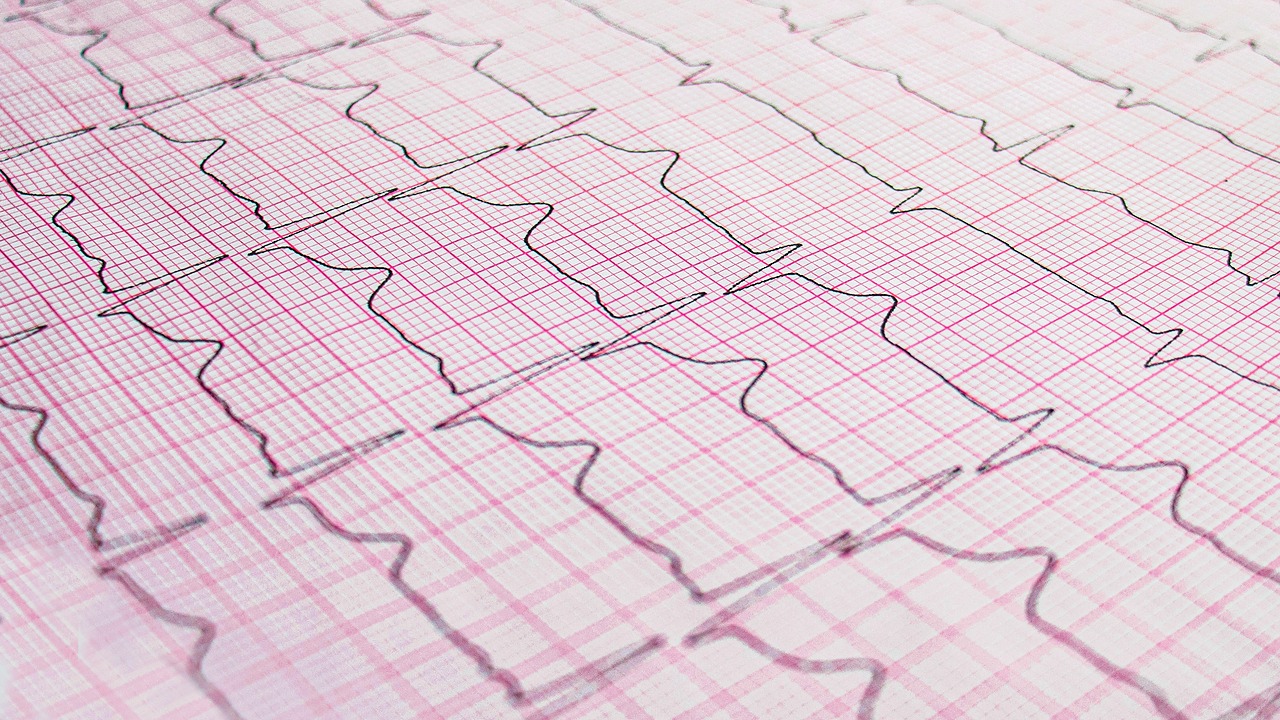 The Hidden Burdens of Congestive Heart Failure - PalliPulse ...